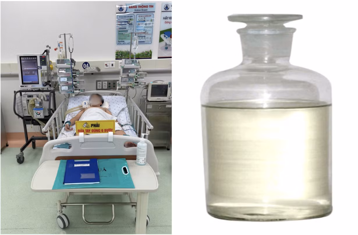 Chai hóa chất dùng để hàn nhựa có thành phần khí styrene đã khiến bé trai nguy kịch