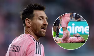 Cập nhật tình trạng chấn thương Messi trước World Cup 2026
