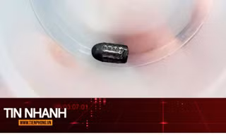 TIN NHANH: Hy hữu người phụ nữ sống sót dù bị đạn lạc găm trúng đầu