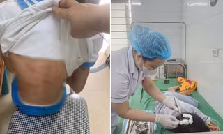 Cha dượng bạo hành bé gái lớp 5 ở Hà Tĩnh có thể đối diện với mức án nào?