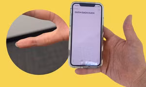 Hội chứng "ngón út smartphone" là gì, có phải chỉ xảy ra ở Gen Z như lời đồn?