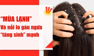 Chuyên gia lo ngại: Mùa lạnh bất thường 2025 làm gàu ngứa, viêm da đầu ‘tăng sinh’
