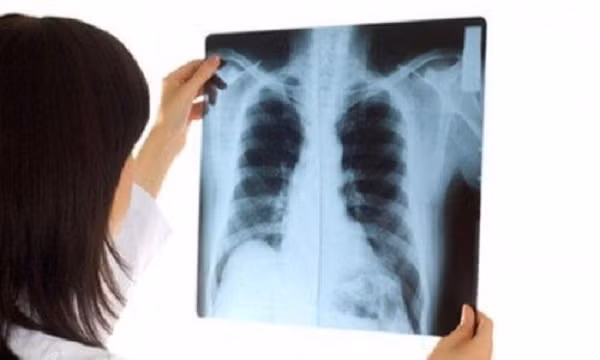 Không muốn đột tử thì đi nắng về đừng làm những việc này ảnh 9