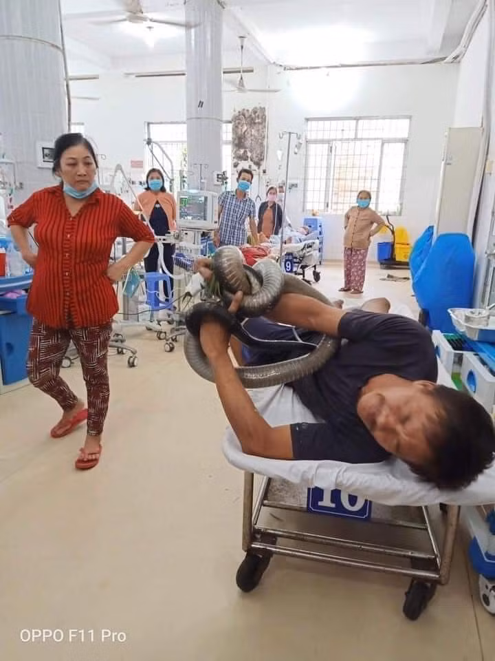 Người đàn ông bị rắn hổ chúa cắn đã có thể tự thở ảnh 1