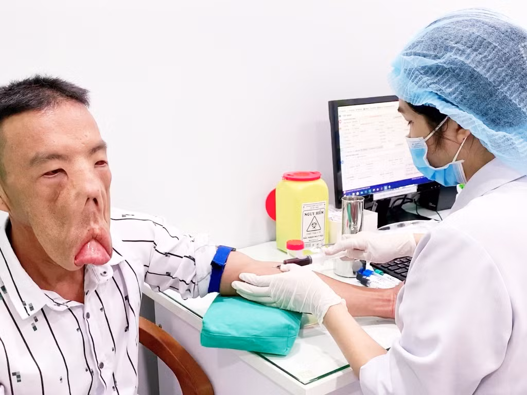 Tìm lại cuộc sống cho chàng trai 'mặt quỷ' ảnh 3