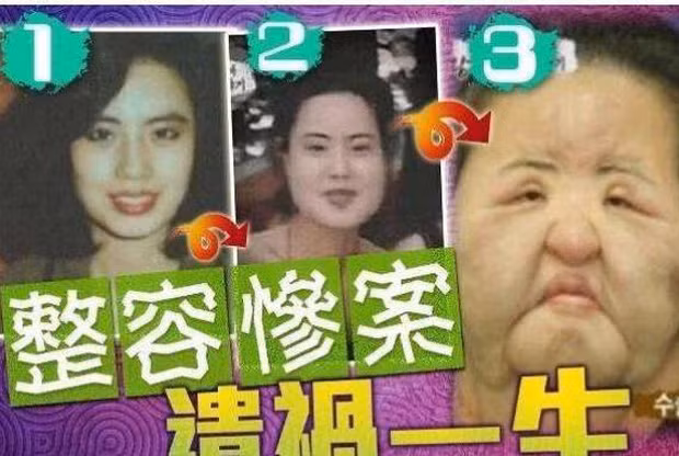  Bi kịch ‘thảm họa thẩm mỹ’ Hàn Quốc: Từ mỹ nhân hóa 'quái vật' ảnh 3