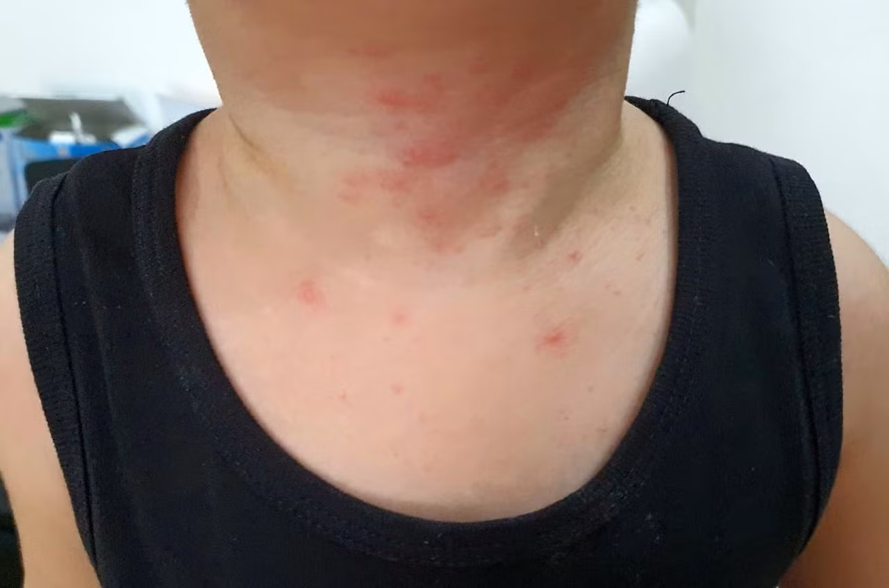 Ban quản lý tự ý pha thuốc diệt khuẩn, cư dân chung cư bị dị ứng? ảnh 1