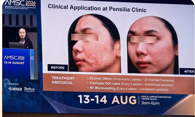 Bác sĩ Việt Nam báo cáo về điều trị bạch biến tại hội nghị thẩm mỹ quốc tế ở Malaysia