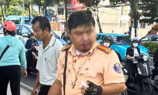 Xử lý va chạm giao thông, 1 cán bộ CSGT ở Nha Trang bị người nước ngoài đấm chảy máu 