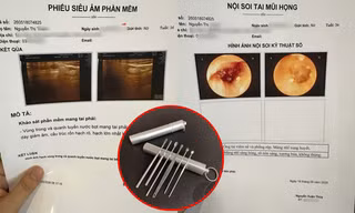 Dùng một loại dụng cụ ngoáy tai quen thuộc, cô gái phải nhập viện điều trị
