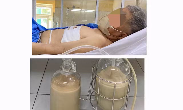 Hút ra hàng lít mủ từ phổi người đàn ông ở Đà Nẵng